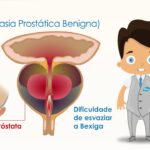 hiperplasia-prostatica-benigna